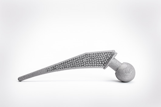 pro-beam_Additiv gefertigtes Modell einer Hüftprothese